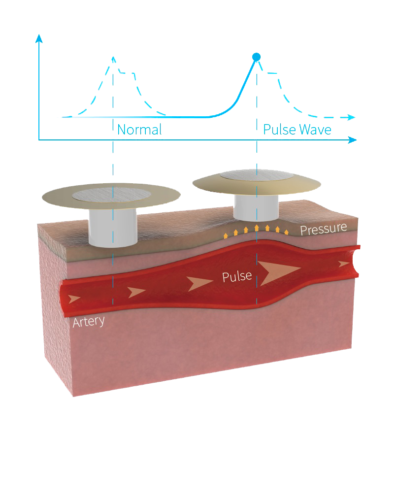Piezoelectric Diagram